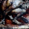 akathesia 1