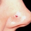 Nostril