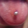 Tongue