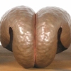 EVOLUTION OF A MEMBRANE -DETAIL