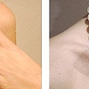 Photo Retouching