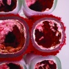 Hearteries A-Z Detail