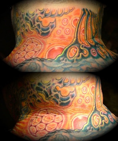 Matt seventko's neck