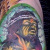 Pilling's leg 1
