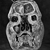 Medical Specimen - 8 x 10 Contact Print