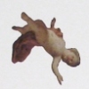 Fertility Treatment Study