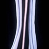 pod 3