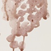 Overripe Grapes