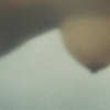 Untitled, Breast