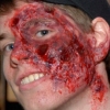 Infected!
