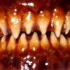 Midnight Vesper Dental Appliance