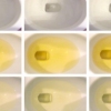 Urine, Detail
