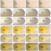 Urine