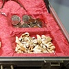The Tooth Fairy's Lost Luggage