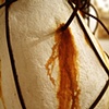 Umbilical Transference
