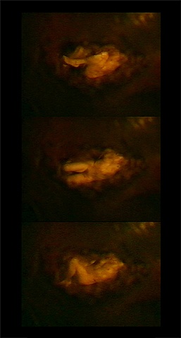 Haroutioun Simonian: Uterus