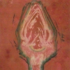 Artichoke