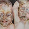 Abortion