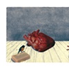 Cross-Species Transplantation
