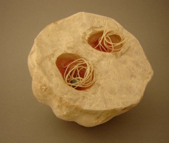 Mitochondria