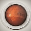 Retina Capture 1