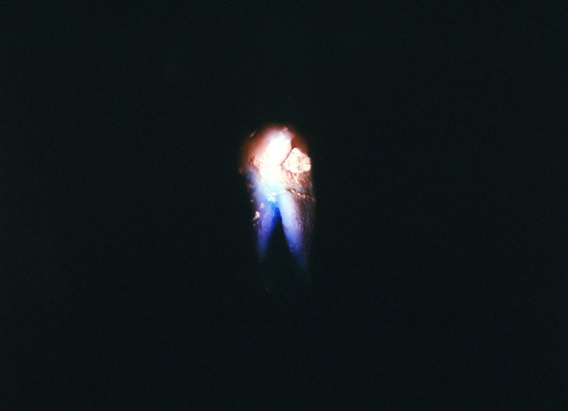 Human Tooth