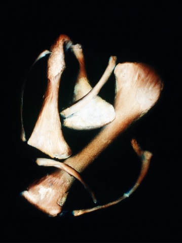 Bones
