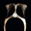 Cat Pelvis