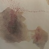Traveling Bruise