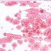 Pink Cells