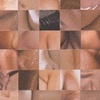 Skin Graph