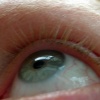 Melissa's Lashes Before