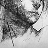 Escaped P.O.W. Showing Her Scars