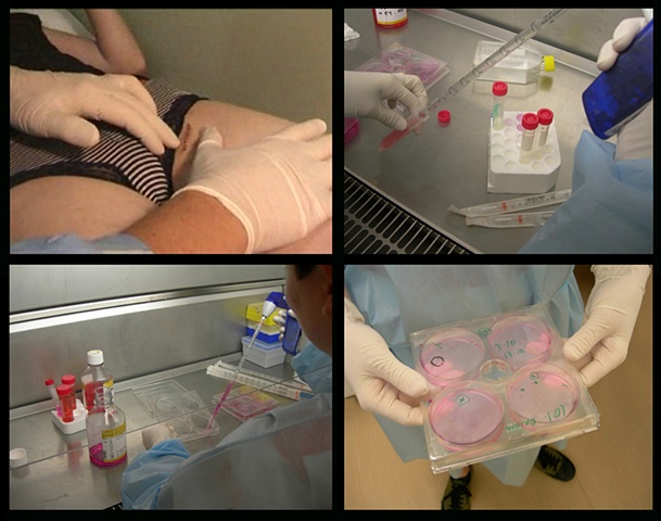 The Ephemeral Flesh Projects - surgery