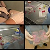 The Ephemeral Flesh Projects - surgery