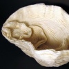 Womb