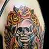 Weiser Arm