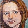 Freckle Face