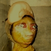 burned girl detail