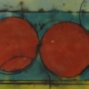 jaundice