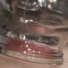 n = [phase 2), Video Still, Subject X, detail.