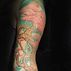 Amanda's Arm