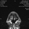 Diagnostic