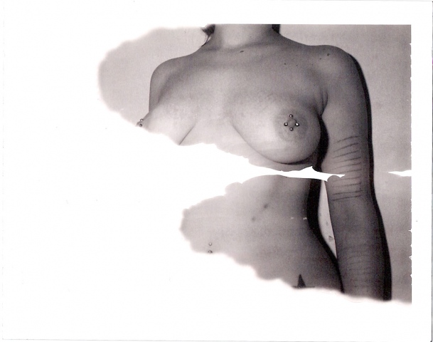 "scars"