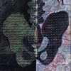 Complications