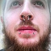 Snake bites