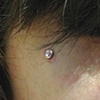 Dermals