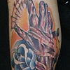 Broken hand