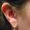 Tragus