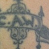 Left arm Before